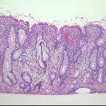 UC IRAP Case 5-1(10x)