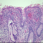 UC IRAP Case 5-2(20x)