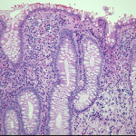 UC IRAP Case 5-3(20x)